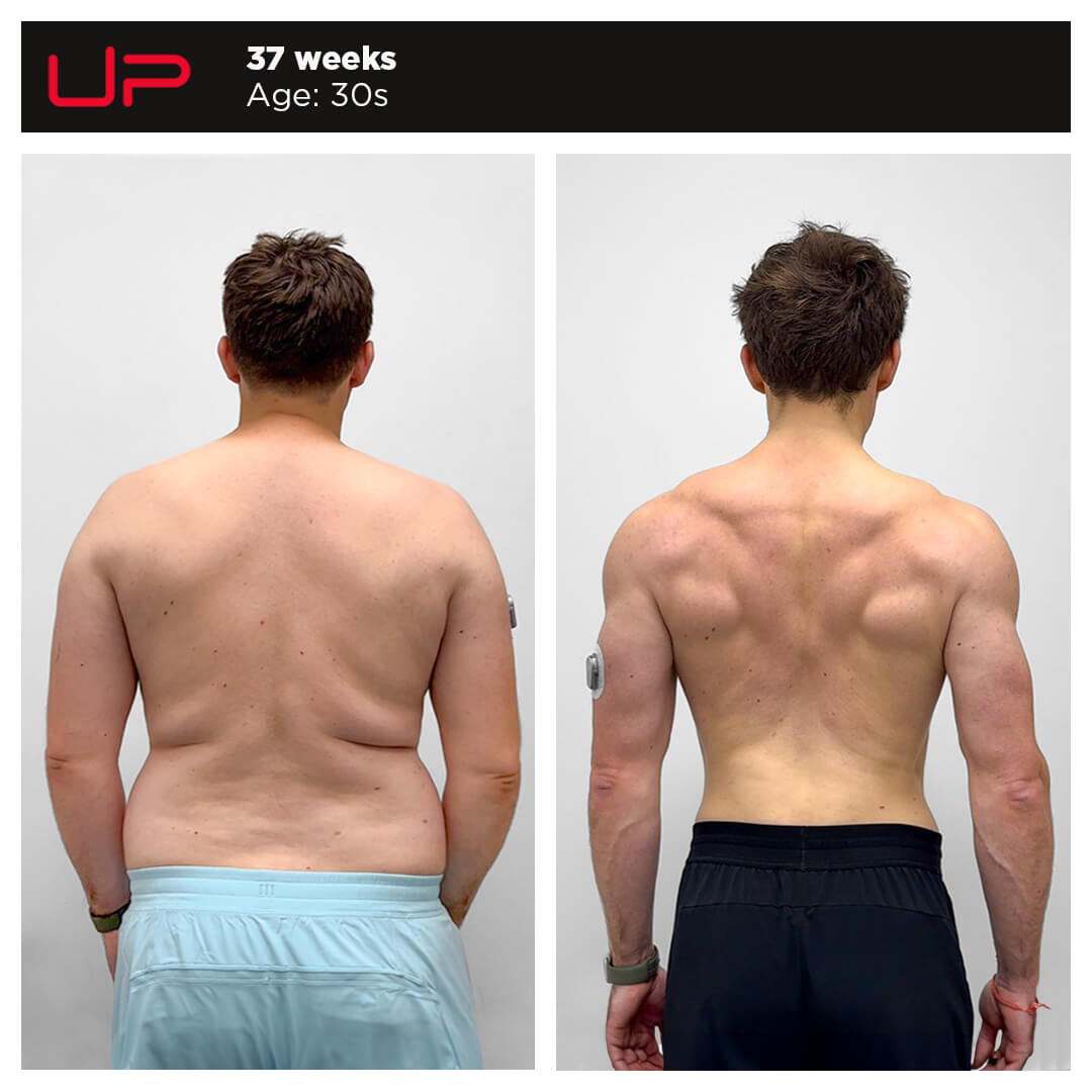 Before and After Personal Training - Sam - Back