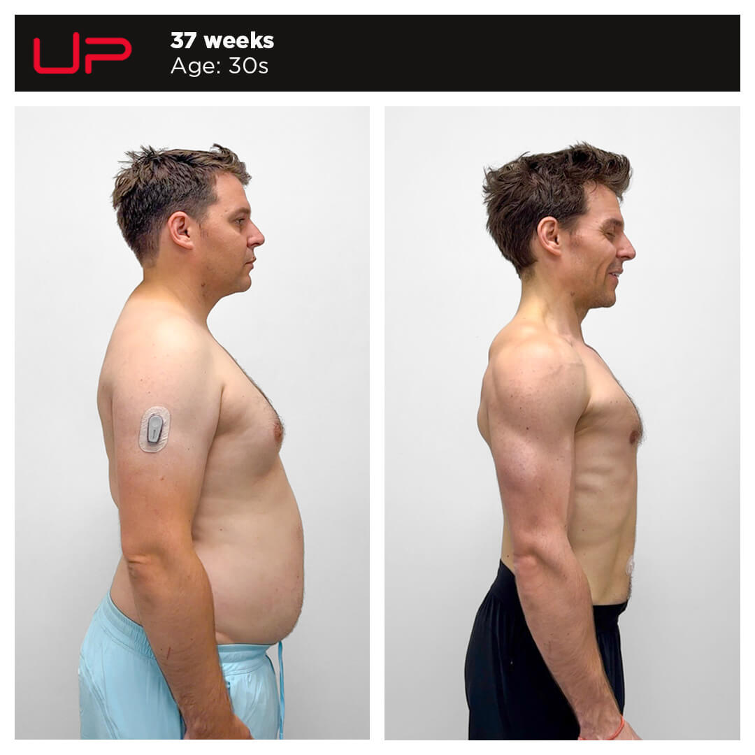 Before and After Personal Training - Sam - Side
