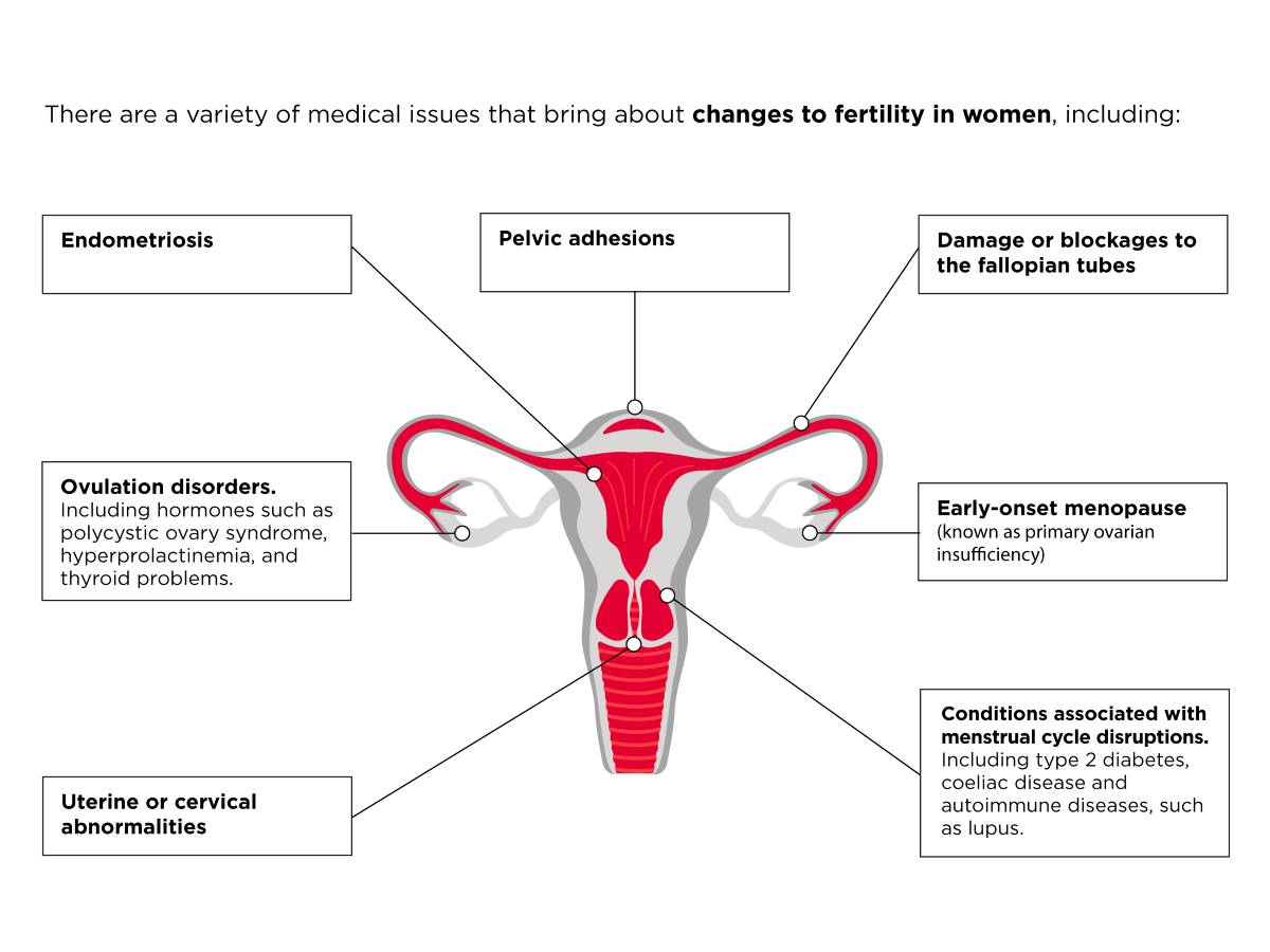 Female Fertility: The Low-Down